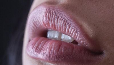 Estos son los beneficios de exfoliar tus labios