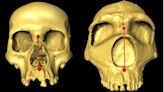 Neanderthals passed down their tall noses to modern humans, genetic analysis finds