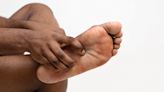 Gout: The Extremely Painful “Unwalkable Disease” - The Baltimore Times