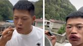 A Chinese influencer said he will 'not admit defeat' after a video of him with swollen lips from eating a live wasp led to backlash