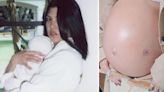 Kourtney Kardashian reveló el motivo de la cirugía fetal de su hijo: “Tenía fluido en los pulmones”