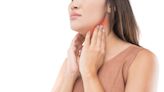 Reasons for Cobblestone Throat and How to Relieve It