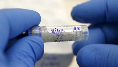 Zika virus can be sexually transmitted from person who is infected, even if asymptomatic: Expert