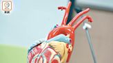 亞洲二尖瓣倒流患者 心臟負荷過重被低估 死亡率較歐美高20%