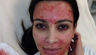 ¿Cómo son los "faciales vampiros" que se aplica Kim Kardashian, y por los que se registran tres casos de VIH?