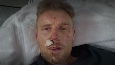 Freddie Flintoff reveals extent of injuries after Top Gear crash