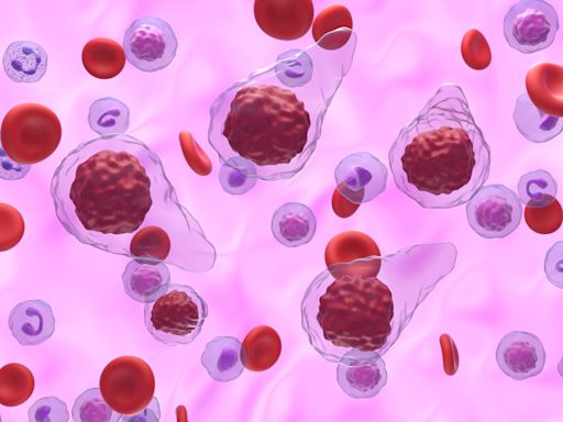 J&J’s Carvykti to make meteoric rise in multiple myeloma