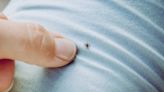 What to Know About Babesiosis, a Tick-Borne Disease That's on the Rise - Consumer Reports