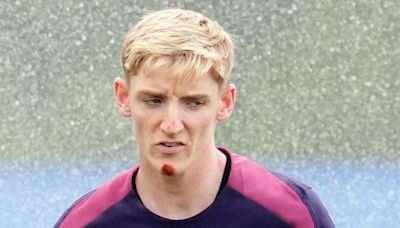 England player Anthony Gordon falls off his bike and gashes chin at Euros camp