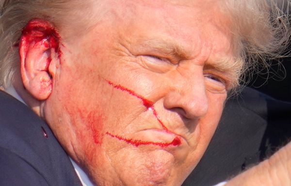 Trump shooting live updates: Ex-president calls on America to ‘stand united’ after assassination attempt