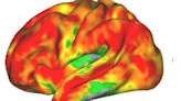 La psilocibina desincroniza la huella cerebral de nuestra personalidad