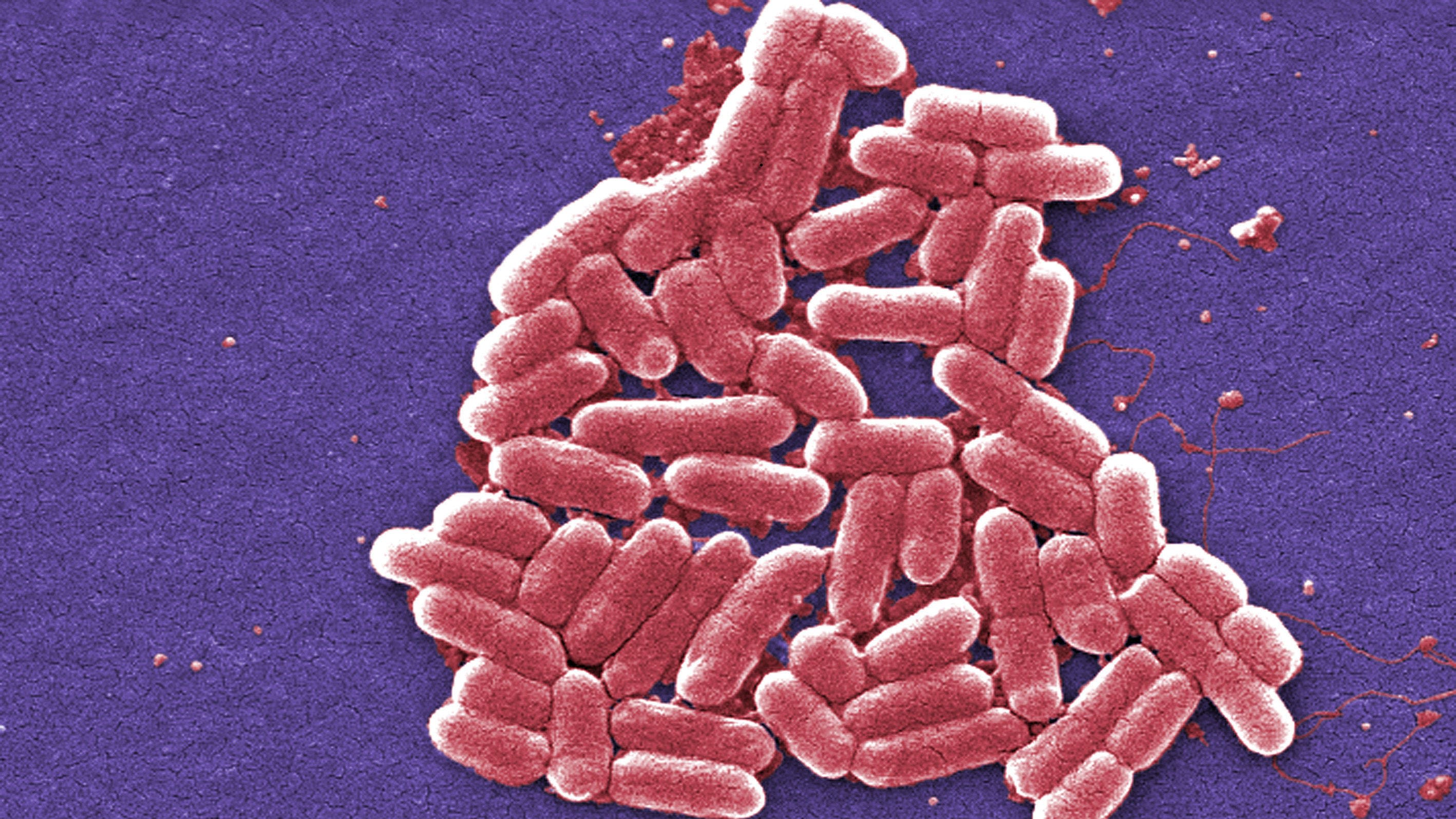 E. coli outbreak: 86 people taken to hospital but cases are slowing down