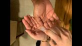 Empresa de Florida retira del mercado desinfectante de manos porque contiene un carcinógeno