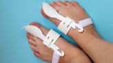 What Are Bunion Correctors, and Can They Cure Bunions?