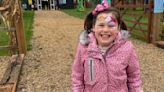 'We thought our daughter was clumsy, but she actually had a painful rare condition'