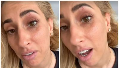 Stacey Solomon reveals she has accidentally given herself a black eye with latest DIY endeavour