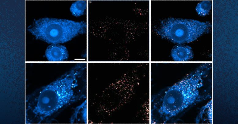 Challenging Old Theories: Innovative Microscopy Exposes New Alzheimer’s Treatment Pathways