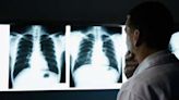 FDA approves Imdelltra for patients with extensive-stage small cell lung cancer