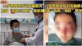 擠痘痘發高燒、臉腫成豬頭 13歲男孩竟患「腦膜炎」