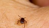 Human Sweat May Prevent Lyme Disease, According to a New Study