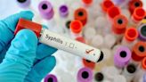 Syphilis Is Increasingly Displaying Atypical, Severe Symptoms