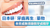 牙齒再生丨日本研「牙齒再生」藥物 未來或無須鑲假牙或植牙？