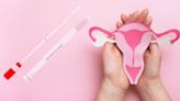 Why 400,000 more women could soon get cervical screening tests every year