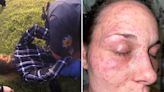 Mulher processa polícia após ser algemada com a cara em formigueiro