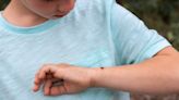 Ticks are here to stay: Expert tips on staying safe as Ontario reports 60 Lyme disease cases in 2024