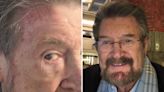 Media personality Derryn Hinch reveals skin cancer battle