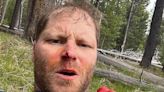 Veteran survives bear attack after animal accidentally bit spray can