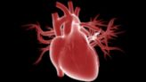 Magenta secures $105m to trial world’s smallest heart pump