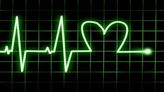 Milestone's (MIST) Tachycardia Study Data Fail to Impress Investors