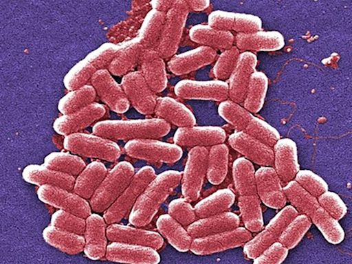 Urgent E coli health warning as more than 100 cases linked to ‘nationally distributed’ food