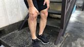 50歲壯男膝蓋有「喀喀」怪聲 醫揭半月板損傷4大症狀