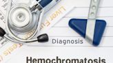 Hammerling-Hodgers: Hemochromatosis can damage organs and shorten life span. Know the signs