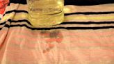 Here's How to Remove Every Type of Annoying Stain