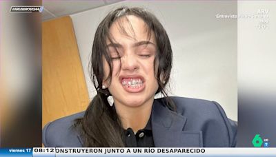 Tatiana Arús alucina con los dientes de colores de Rosalía: "El brillante está torcido, no sé si al comer carne se le ha movido"