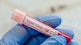 Nipah monoclonal antibody to undergo human trials in India, Bangladesh in 2025