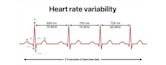 Heart rate variability