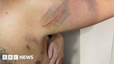 Bridgend: Evri delivery driver attacked by dog