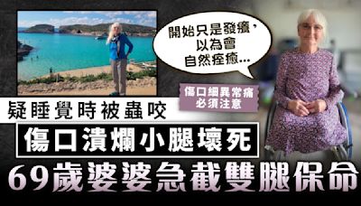 小傷口變大病｜疑睡覺時被蟲咬 傷口潰爛小腿壞死 69歲婆婆急截雙腿保命