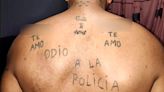 “Odio a la policía”: el tatuaje tumbero del temible ladrón de González Catán detenido por balear a un papá y a su hijo