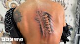 Scoliosis patient hopes new tattoo will 'stop the bullying'