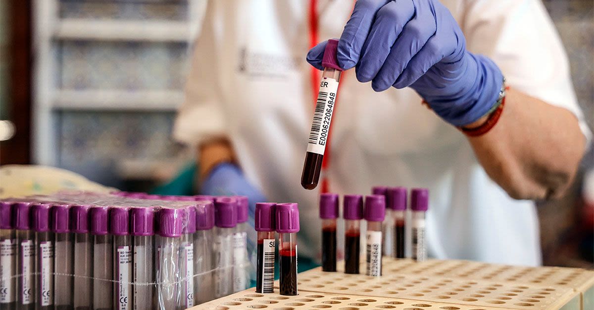 Alzheimer's: New blood test may help catch 90% of cases