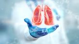 EMA CHMP supports CStone’s sugemalimab for metastatic NSCLC