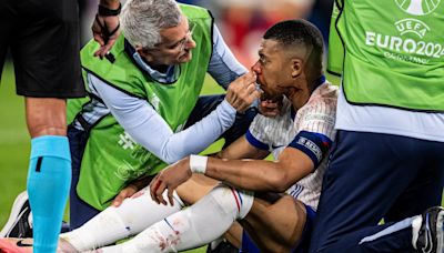 Kylian Mbappe’s Euros in doubt after breaking his nose during narrow France win