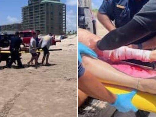 July 4 horror! Four people injured in shark attacks on Texas beach