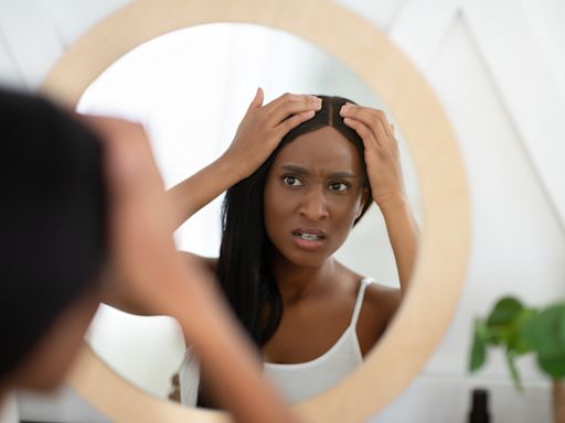 5 reasons women experience hair loss