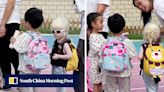‘Everyone likes her’: albino girl’s warm welcome at kindergarten inspires millions